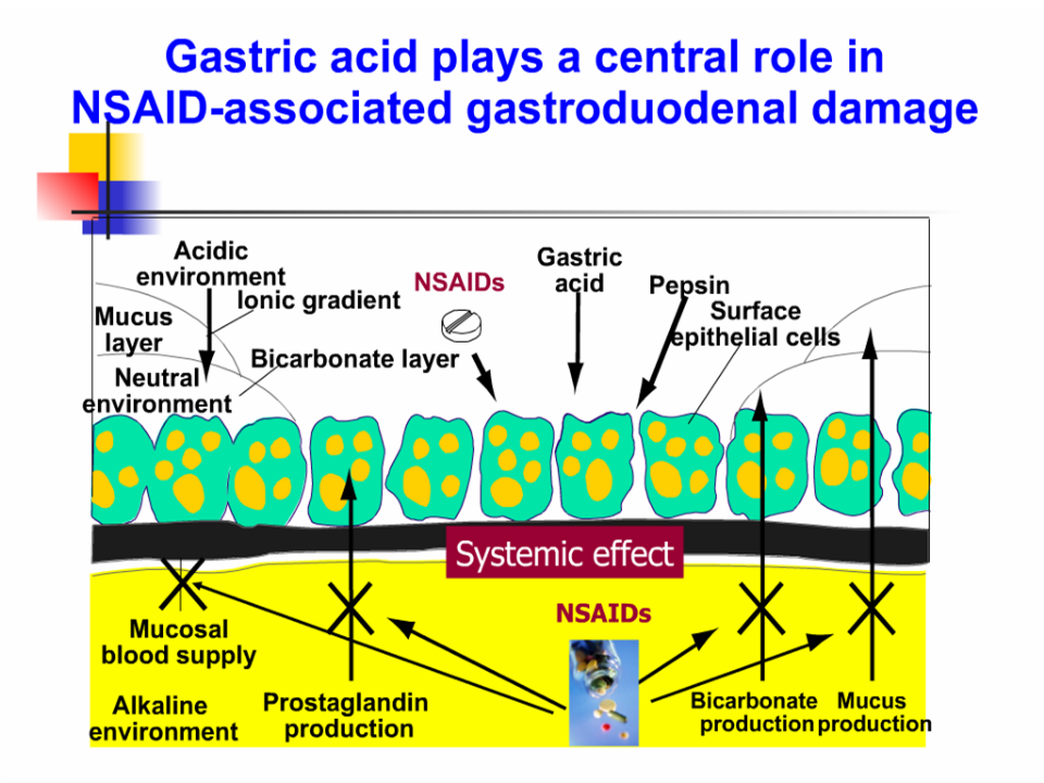 Drug nsaids induced peptic ulcer and management gi update