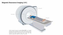 Magnetic Resonance Imaging (MRI)